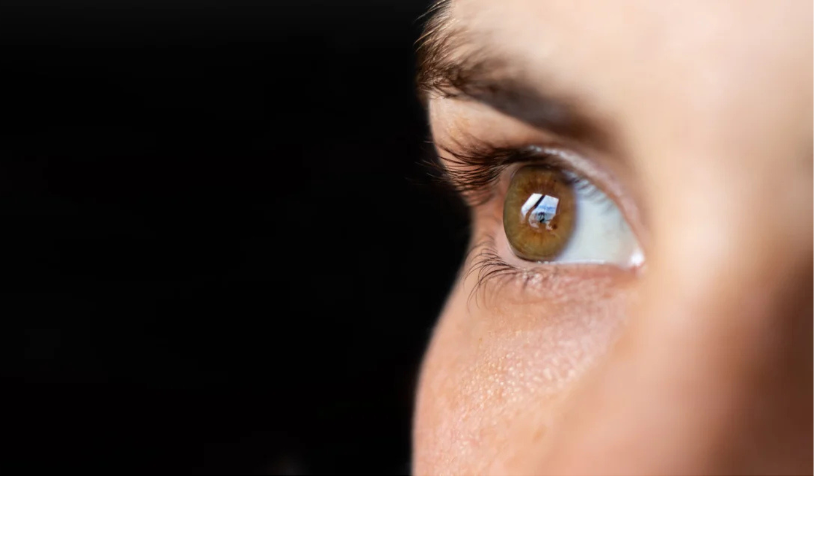 Conyers keratoconus eye 6